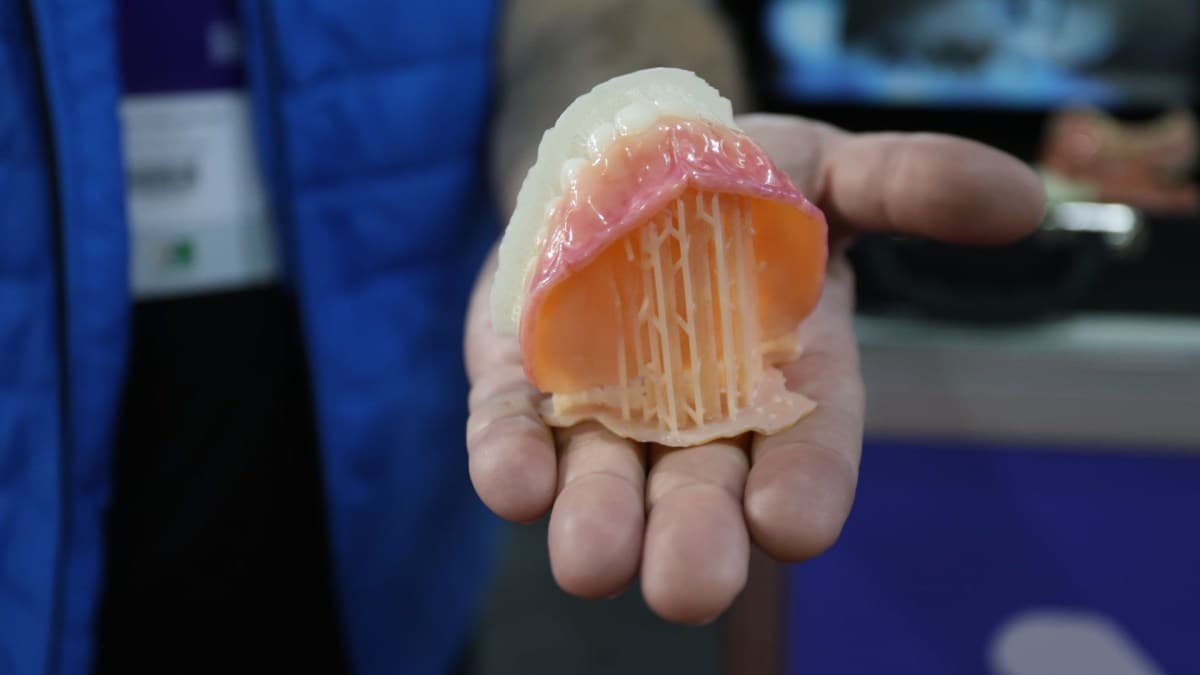 Tecnologia transforma moldagem de próteses dentárias no SUS