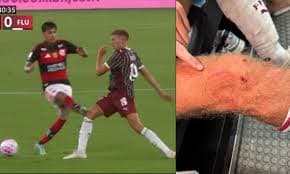 O impacto da ética no futebol e o caso de Erick Pulgar