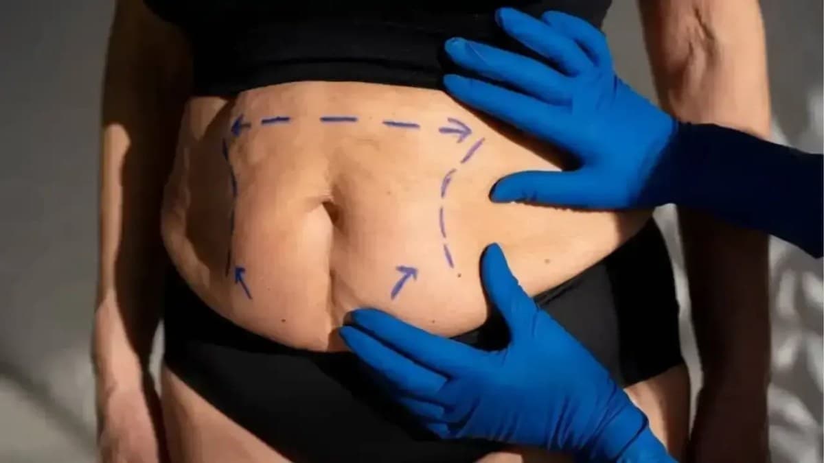 Cirurgião Marco Dallegrave discute estética e autoestima