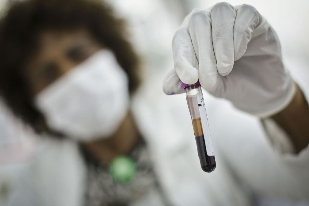 Novo exame prevê Alzheimer anos antes com RNAs circulares