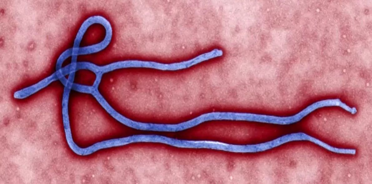 Caso suspeito de Ebola em idoso na Grande Porto Alegre é descartado