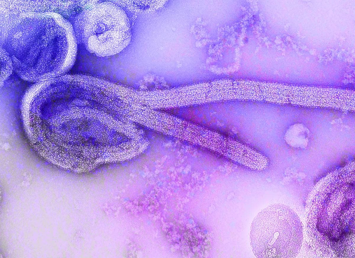 Suspeita de Ebola em Nova Hamburgo gera monitoramento de saúde
